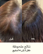 ⁦شامبو البيلون لتغذية الشعر⁩ - الصورة ⁦5⁩