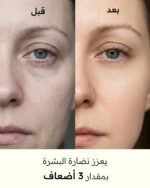 ⁦ماسك البيلون لنضارة البشرة⁩ - الصورة ⁦6⁩