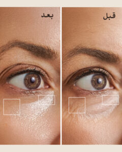 صورة المكوّنات