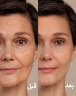 ⁦سيرم الشباب الريتينول المغلف⁩ - الصورة ⁦6⁩