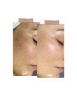 ⁦سيرم فيتامين سي للإشراقة⁩ - الصورة ⁦5⁩