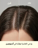 ⁦العناية بالشعر ضد القشرة⁩ - الصورة ⁦4⁩